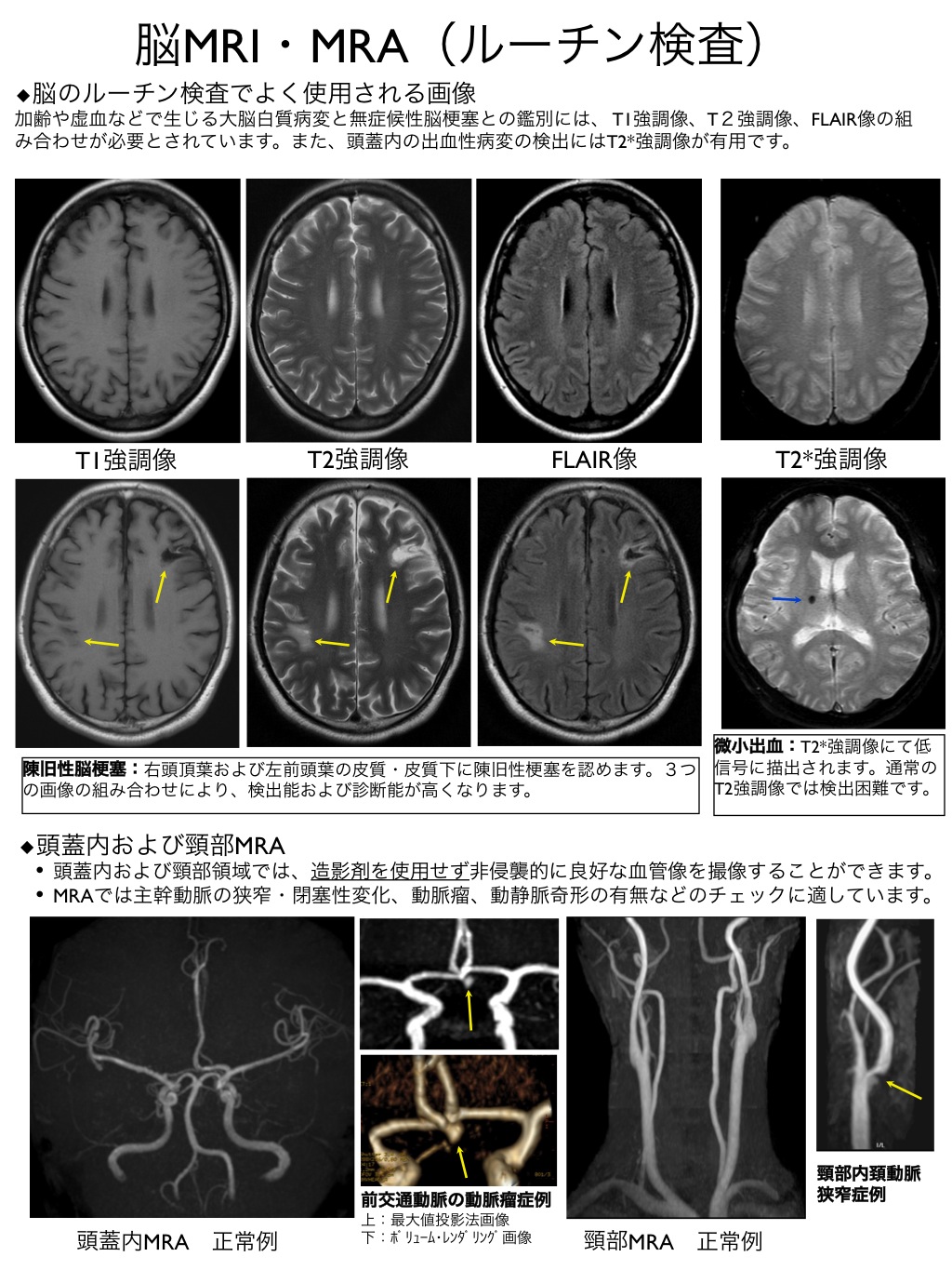 画像集 | 画像診断 | 医療法人 秀放会 仙台総合放射線クリニック